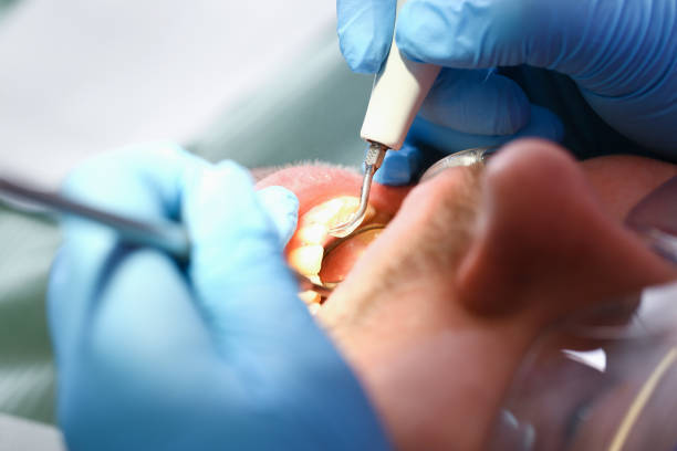 Best Emergency Broken Tooth Repair in Powhatan Point, OH